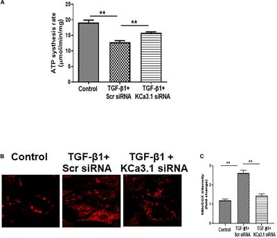 KCa3.1 Mediates Dysregulation of Mitochondrial Quality Control in Diabetic Kidney Disease